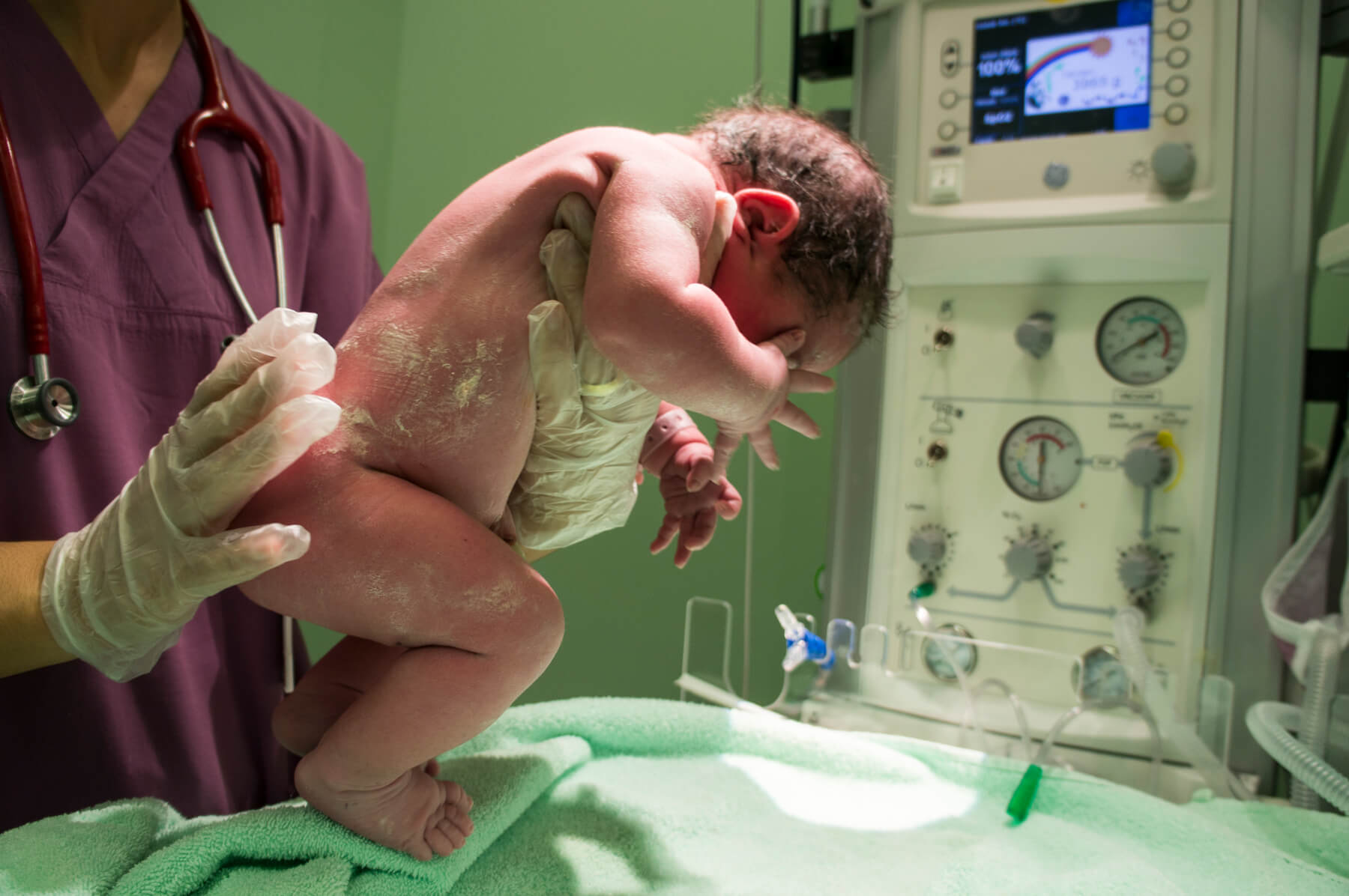 Ultrazvuk mozga, dojenčad,, bebe